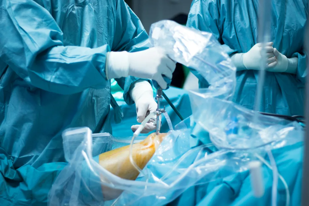 Équipe chirurgicale réalisant une arthroscopie du genou au bloc opératoire