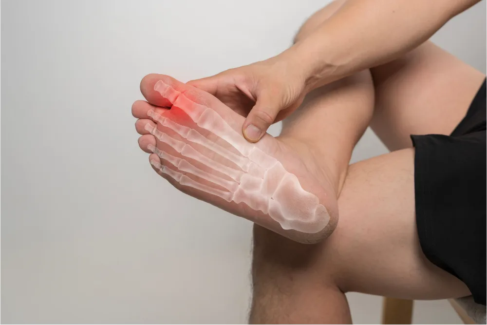 Gros orteil raide et douloureux évoquant un hallux rigidus