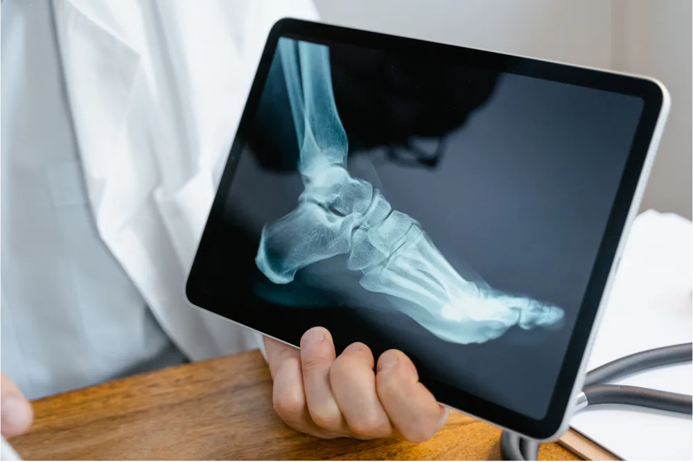 Pied examiné en consultation de chirurgie orthopédique à Aubagne