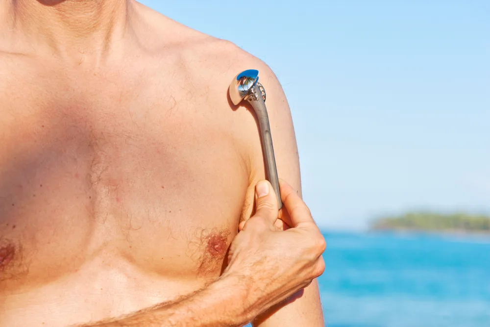 Implant de prothèse d’épaule tenu à la main